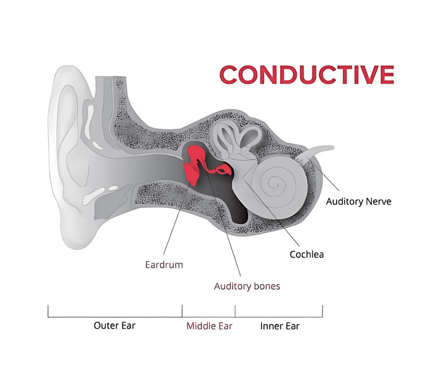 Types Of Hearing Loss Quality Hearing Care